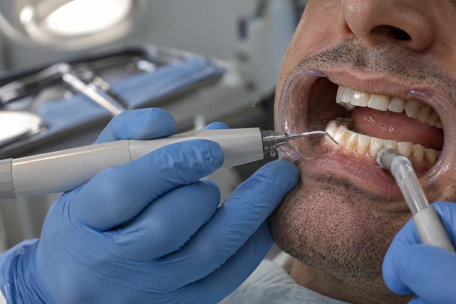 Higienista realizando limpeza dentária com aparelho de ultrassom em consultório odontológico. Tudo para explicar limpeza dentária tira cárie.