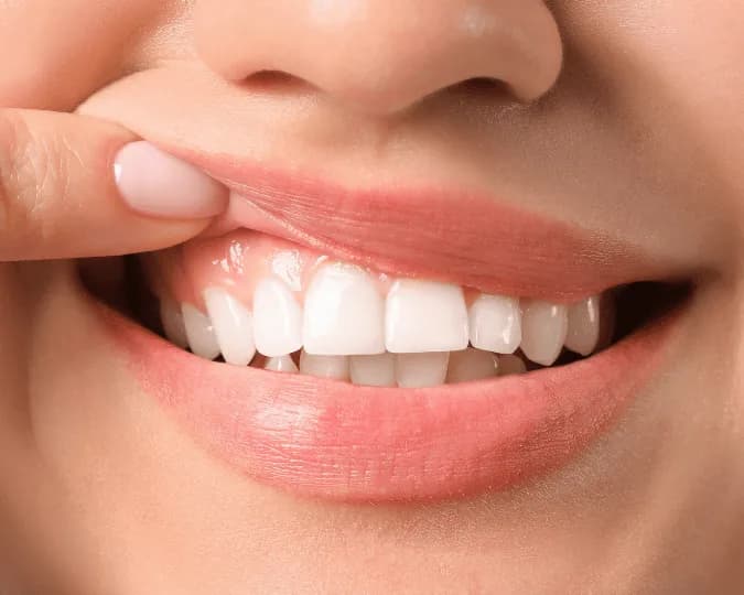 Estética gengival na Prodentex