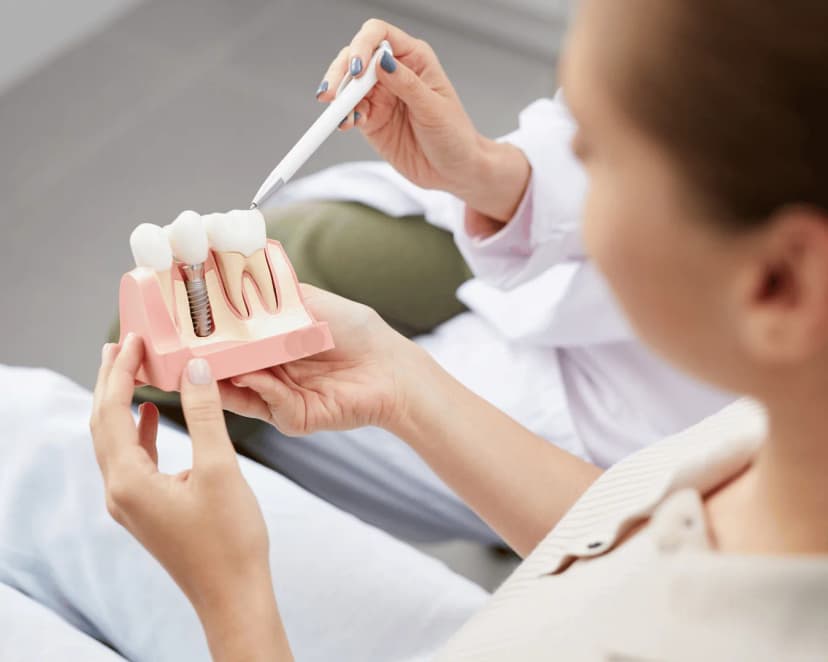 Implante dentário na Prodentex