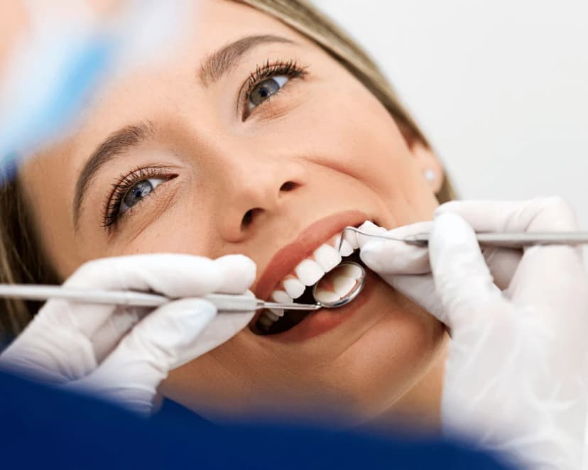 Lentes dentárias na Prodentex