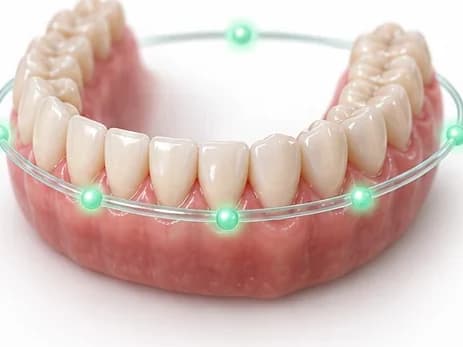 Arcada limpa ao fim da limpeza dental na Prodentex, em Joinville, com o retorno já programado