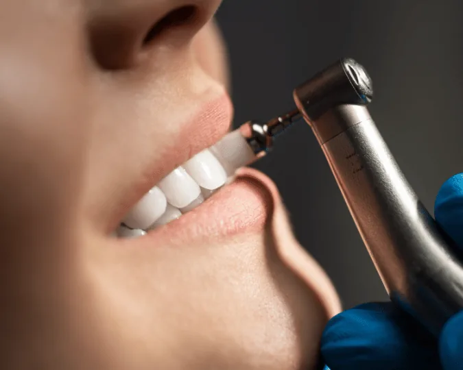 Limpeza dentária na Prodentex